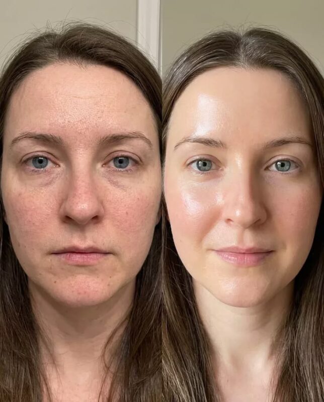 What do polypeptides do for skin